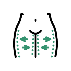 رفع چربی ران        